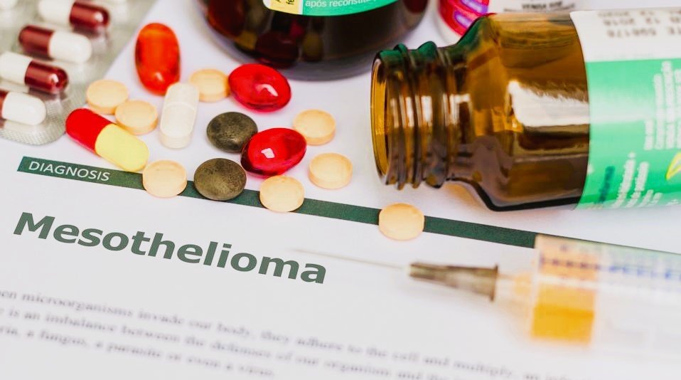 How to File for Mesothelioma Compensation [2023]